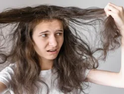 Sering Mengalami Masalah Rambut Rontok, Berikut 6 Penyebab Kebotakan Dini Pada Perempuan